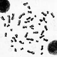 Chromosomes